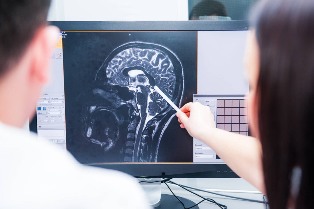 Medical professionals examining a brain scan to identify trauma, illustrating how a Philadelphia brain injury lawyer uses clinical evidence to counter insurance defenses.